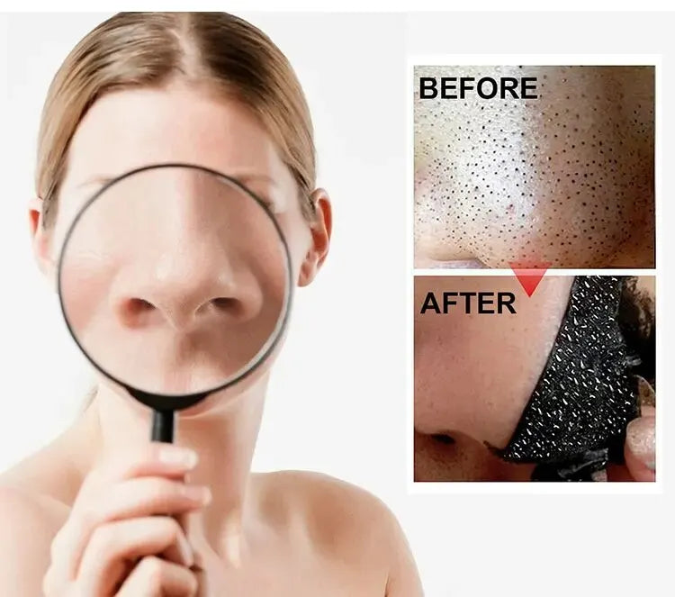 Black Pig Nose Stick Bamboo Charcoal To Remove Blackheads, Remove Acne, Clean Pores, Adsorb Oil And Dirt Nose Film Nose Stick